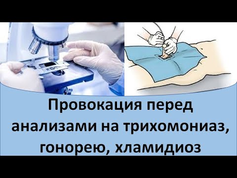 Видео: Провокация перед анализами на трихомонады, гонорею и хламидиоз