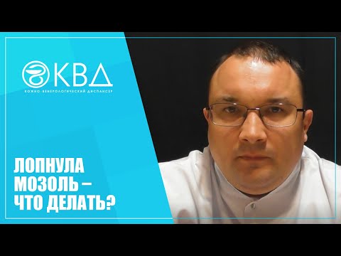 Видео: 1238  Лопнула мозоль – что делать?
