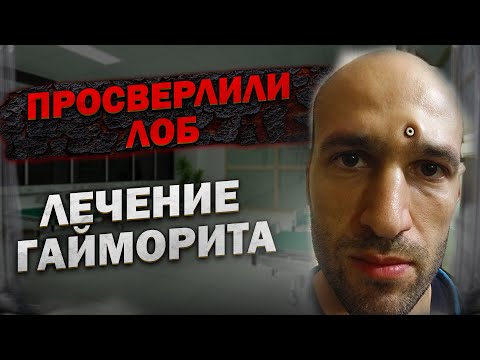 Видео: Ошибки при лечении гайморита. Возможно ли лечение гайморита в домашних условиях