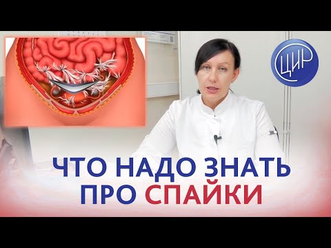 Видео: Спаечный процесс в малом тазу. Всё, что нужно знать про спайки в малом тазу. Лутовинова О.А.