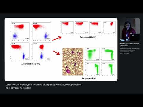 Видео: Цитометрическая диагностика экстрамедуллярного поражения при острых лейкозах