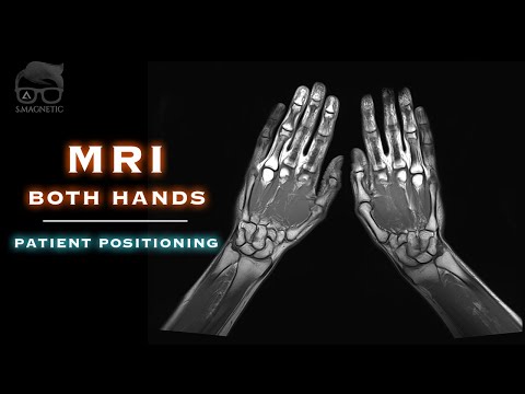 Видео: МРТ – ОБЕ РУКИ – РАСПОЛОЖЕНИЕ ПАЦИЕНТА