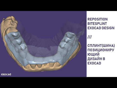 Видео: Дизайн позиционирующего сплинта в Exocad / Reposition bite splint design in Exocad