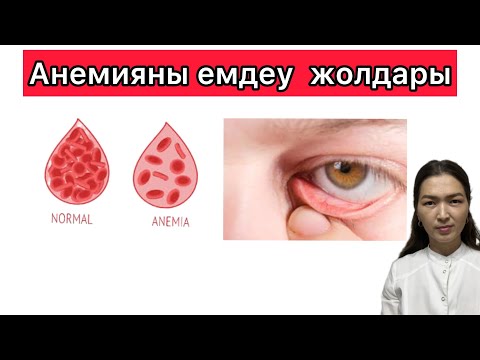 Видео: Анемияның белгілері/ Анемияның емдеу жолдары #анемия