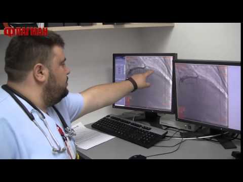 Видео: Безплатни кардиологични прегледи в Бургас