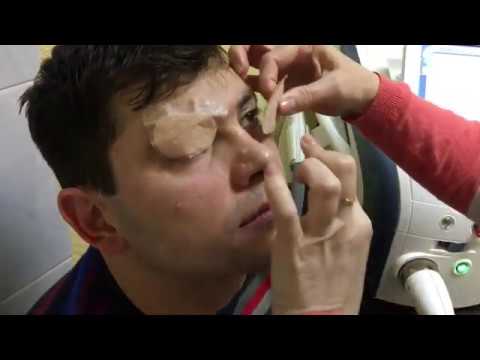 Видео: M22 и офтальмология: лечение синдрома сухого глаза