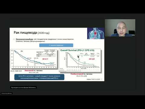 Видео: Лучшее по материалам конференций ESMO 2020, посвященным опухолям желудочно-кишечного тракта