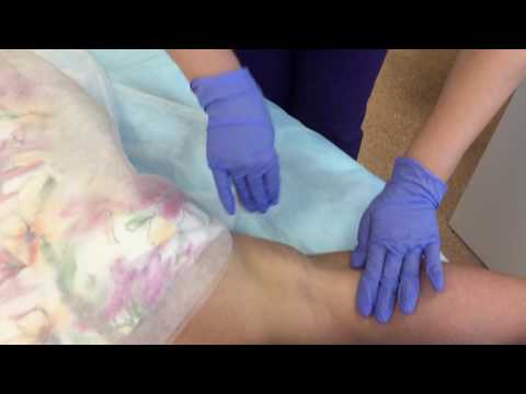 Видео: Лечение гипергидроза (потливости) FR методом