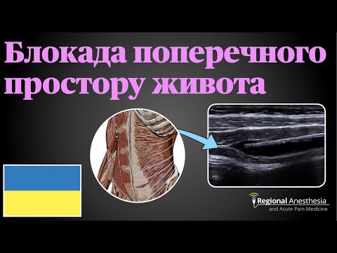 Видео: Блокада поперечного простору живота (TAP блокада) 🇺🇦 (Transversus abdominis plane [TAP] Block)