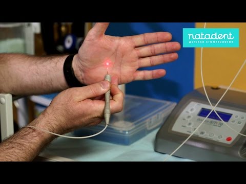 Видео: 09. Про короткую уздечку языка! Натадент