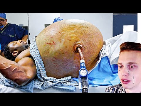 Видео: Попробуй не скажи ОЙ! / РЕАКЦИЯ на САМОЕ НЕПРИЯТНОЕ ВИДЕО на ПЛАНЕТЕ