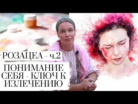 Видео: РОЗАЦЕА ЧАСТЬ 2  || ROSACEA || ПСИХОСОМАТИКА КОЖНЫХ ПРОЯВЛЕНИЙ || УПРАЖНЕНИЕ В КОНЦЕ ВИДЕО