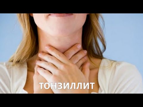 Видео: Хронический тонзиллит: как с ним жить?