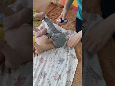 Видео: Массаж и тейпирование при пупочной грыже