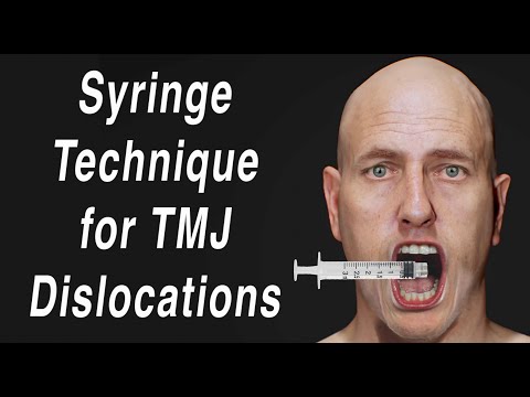 Видео: Шприцевой метод самовосстановления вывиха ВНЧС