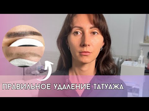 Видео: Хочешь удалить старый перманентный макияж? Удаление татуажа лазером и ремувером!