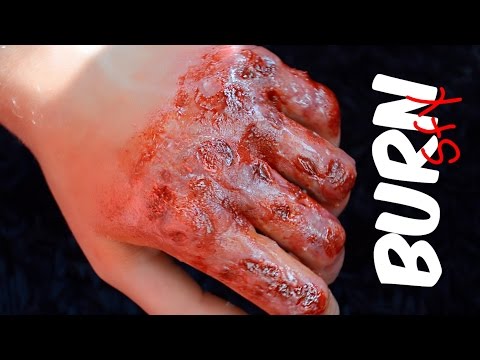 Видео: КИНОЭФФЕКТЫ: Ожог