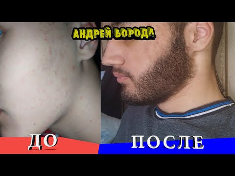 Видео: Запустил рост бороды / Мазал 1 год / Теперь его нельзя продавать на ВБ / ВЫПУСК №6 / Андрей Борода