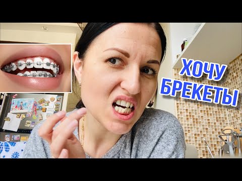 Видео: ВЛОГ Мечтаю и Боюсь ставить брекеты 😰 Металические или керамические брекеты?
