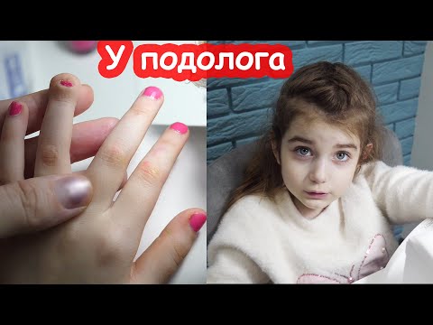 Видео: VLOG Что мы решили с ногтиком. Удалять его или нет. Первый маникюр в 5 лет