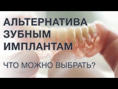 Видео: Чем заменить зубной имплант? Альтернатива имплантации зубов.