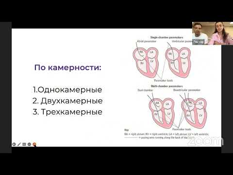 Видео: Основы электрокардиостимуляции (04.09.2024)