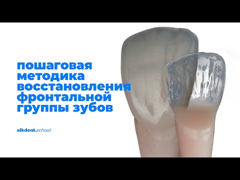 Видео: Пошаговая методика восстановления фронтальной группы зубов. Билламинарная техника. aikdent.school