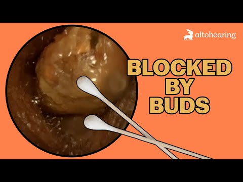 Видео: Использование ватных палочек или ватных палочек ухудшает состояние ушной серы