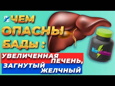 Видео: Почему печень бывает увеличенной, а желчный пузырь загнутым. Артишок. Чем бывают опасны БАДы