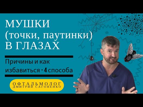 Видео: Мушки перед глазами 🪰👀- причины и как изабавиться (4 способа) от плавающих и мелькающих точек