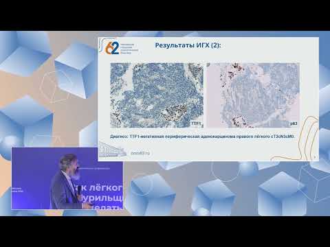Видео: Савелов - Рак легкого без драйверных мутаций взгляд патолога и генетика