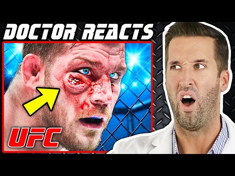 Видео: ВРАЧ смотрит на худшие травмы ММА в истории UFC