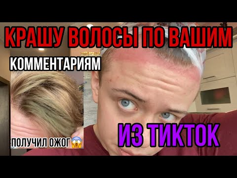 Видео: ПОЛУЧИЛ ОЖОГ😱/КРАШУ ВОЛОСЫ ПО ВАШИМ КОММЕНТАРИЯМ ИЗ ТИК ТОК🤯