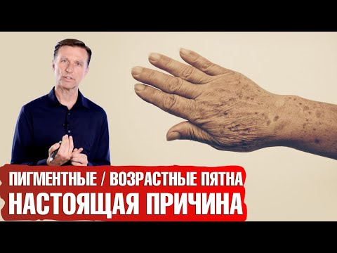 Видео: Возрастные пигментные пятна. Как избавиться от печеночных пятен