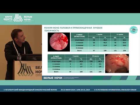 Видео: Значение лучевой терапии в лечении рака предстательной железы (Новиков Р.В.)