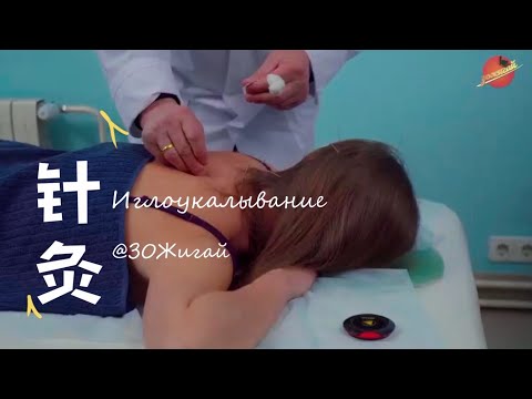 Видео: Чем полезно иглоукалывание и что им лечат? ЗОЖигай! – Наталья Корнева & Виталик Мишура