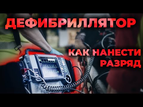 Видео: Дефибриллятор и дефибрилляция. Как правильно пользоваться и наносить разряд при СЛР #ПроСМП