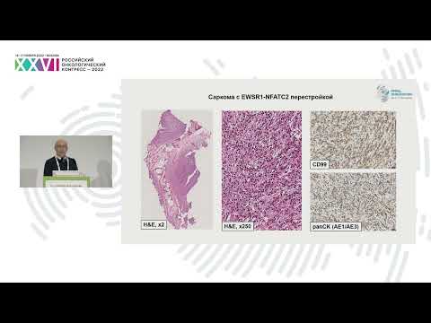 Видео: Обновленная классификация опухолей костей (WHO 2020)