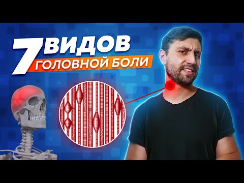 Видео: Почему болит голова? 7 видов головных болей