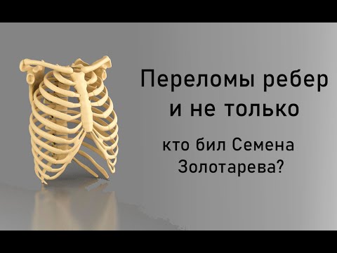 Видео: Переломы ребер. И не только. Кто бил Семена Золотарева?