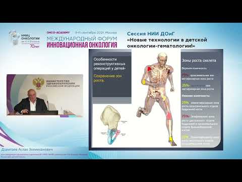 Видео: Эндопротезирование в детской онокологии.