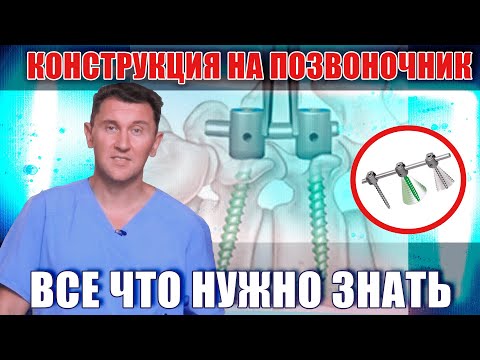 Видео: Конструкция на позвоночник может сломаться? Ответы на вопросы.