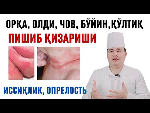 Видео: ИШТОН ИЧИ, ҚЎЛТИҚ, ЧОТ ПИШИБ КЕТИШИ, ИССИҚЛИК ТОШМА ЧИҚИШИ САБАБИ, АСОРАТИ ВА ДАВОСИ ХАҚИДА ИСЧАНОВ
