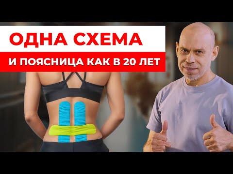 Видео: 1 ЭФФЕКТИВНАЯ схема при гиперлордозе! Тейпирование для ровной осанки