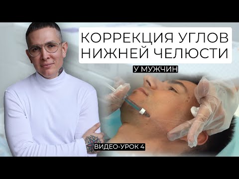 Видео: Коррекция углов нижней челюсти у мужчин КАНЮЛЕЙ Видео-Урок