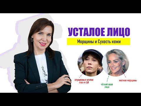 Видео: Усталое лицо, Морщины и Сухость кожи - Причины и план действий