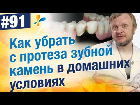Видео: Как в домашних условиях убрать зубной камень на съемном протезе?