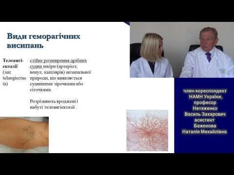 Видео: Основні симптоми та синдроми при геморагічних діатезах