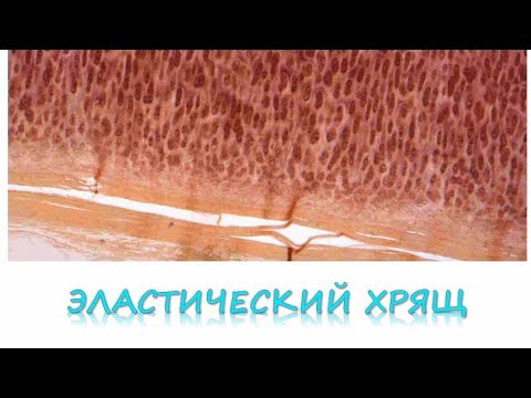 Видео: ЭЛАСТИЧЕСКИЙ ХРЯЩ