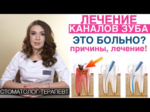 Видео: Лечение каналов зубов, пломбирование зубных каналов, лечение пульпита, удаление нерва из зуба!